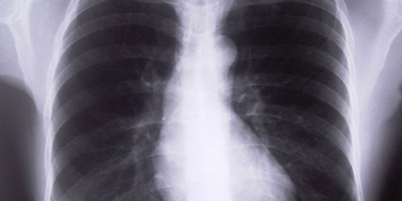 Zbadaj darmowo płuca