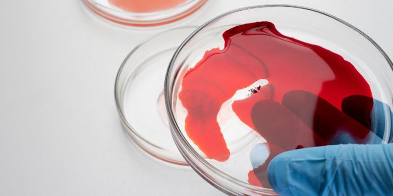 „Choroba królów” wciąż obecna. Na Mazowszu ponad tysiąc pacjentów z hemofilią